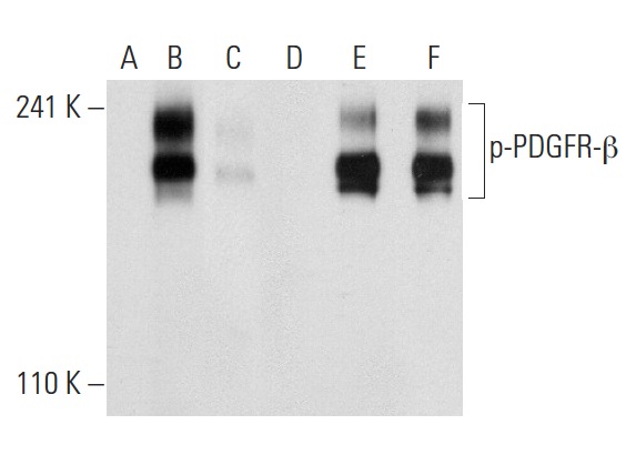 Western blot analysis of PDGFR-β phosphorylation in non-transfected: sc-117752 (A,D), untreated human PDGFR-β transfected: sc-159386 (B,E) and lambda protein phosphatase treated human PDGFR-β transfected: sc-159386 (C,F) 293T whole cell lysates. Antibodies tested include p-PDGFR-β (Tyr 579): sc-135671 (A,B,C) and PDGFR-β (11H4): sc-80991 (D,E,F).