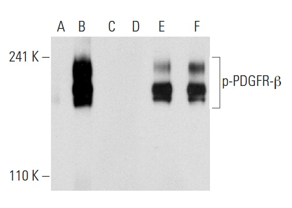 Western blot analysis of PDGFR-β phosphorylation in non-transfected: sc-117752 (A,D), untreated human PDGFR-β transfected: sc-159386 (B,E) and lambda protein phosphatase treated human PDGFR-β transfected: sc-159386 (C,F) 293T whole cell lysates. Antibodies tested include p-PDGFR-β (Tyr 1021): sc-12909-R (A,B,C) and PDGFR-β (11H4): sc-80991 (D,E,F).