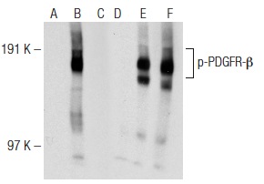 Western blot analysis of PDGFR-β phosphorylation in untreated (A,D), PDGFββ treated (B,E) and PDGFββ and lambda protein phosphatase (sc-200312A) treated (C,F) NIH/3T3 whole cell lysates. Antibodies tested include p-PDGFR-β (F-10): sc-365464 (A,B,C) and PDGFR-β (11H4): sc-80991 (D,E,F).