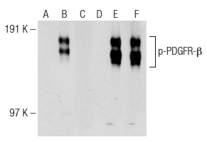 Western blot analysis of PDGFR-β phosphorylation in non-transfected: sc-117752 (A,D), untreated human PDGFR-β transfected: sc-159386 (B,E) and lambda protein phosphatase (sc-200312A) treated human PDGFR-β transfected: sc-159386 (C,F) 293T whole cell lysates. Antibodies tested include p-PDGFR-β (F-10): sc-365464 (A,B,C) and PDGFR-β (11H4): sc-80991 (D,E,F).