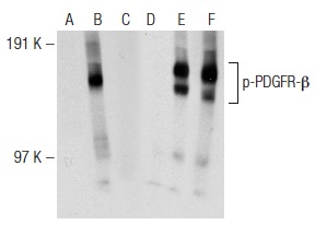 Western blot analysis of PDGFR-β phosphorylation in untreated (A,D), PDGFββ treated (B,E) and PDGFββ and lambda protein phosphatase (sc-200312A) treated (C,F) NIH/3T3 whole cell lysates. Antibodies tested include p-PDGFR-β (H-3): sc-365465 (A,B,C) and PDGFR-β (11H4): sc-80991 (D,E,F).