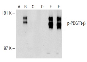 Western blot analysis of PDGFR-β phosphorylation in non-transfected: sc-117752 (A,D), untreated human PDGFR-β transfected: sc-159386 (B,E) and lambda protein phosphatase (sc-200312A) treated human PDGFR-β transfected: sc-159386 (C,F) 293T whole cell lysates. Antibodies tested include p-PDGFR-β (H-3): sc-365464 (A,B,C) and PDGFR-β (11H4): sc-80991 (D,E,F).