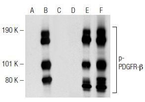 Western blot analysis of PDGFR-β phosphorylation in non-transfected: sc-117752 (A,D), untreated human PDGFR-β transfected: sc-159386 (B,E) and lambda protein phosphatase (sc-200312A) treated human PDGFR-β transfected: sc-159386 (C,F) 293T whole cell lysates. Antibodies tested include p-PDGFR-β (H-8): sc-373805 (A,B,C) and PDGFR-β (11H4): sc-80991 (D,E,F).