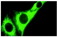 PDGFR-β (958): sc-432. Cytoplasmic immunofluorescence staining of methanol-fixed NIH/3T3 fibroblasts.