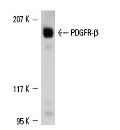 PDGFR-β (958): sc-432. Western blot analysis of PDGFR-β expression in CCD-1064Sk whole cell lysate.