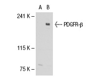 PDGFR-β (958): sc-432. Western blot analysis of PDGFR-β expression in non-transfected: sc-117752 (A) and human PDGFR-β transfected: sc-114235 (B) 293T whole cell lysates.