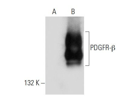 PDGFR-β (958): sc-432. Western blot analysis of PDGFR-β expression in non-transfected: sc-117752 (A) and human PDGFR-β transfected: sc-159386 (B) 293T whole cell lysates.