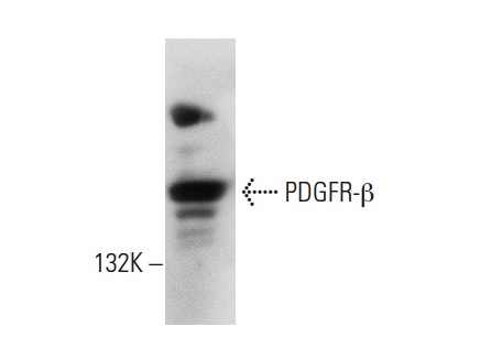 PDGFR-β (958): sc-432. Western blot analysis of PDGFR-β expression in NIH/3T3 nuclear extract.
