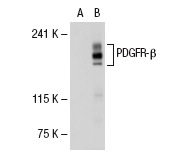 PDGFR-β (M-20): sc-1627. Western blot analysis of PDGFR-β expression in non-transfected: sc-117752 (A) and human PDGFR-β transfected: sc-114235 (B) 293T whole cell lysates.