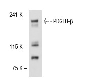 PDGFR-β (M-20): sc-1627. Western blot analysis of PDGFR-β expression in CCD-1064Sk whole cell lysate.