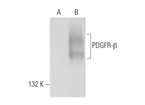 PDGFR-β (M-20): sc-1627. Western blot analysis of PDGFR-β expression in non-transfected: sc-117752 (A) and human PDGFR-β transfected: sc-159386 (B) 293T whole cell lysates.
