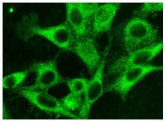 PDGFR-β (M-20): sc-1627. Immunofluorescence staining of methanol-fixed NIH/3T3 cells showing cytoplasmic localization.
