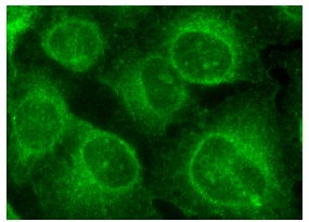 PDGFR-β (M-20): sc-1627. Immunofluorescence staining of methanol-fixed HeLa cells showing membrane and cytoplasmic localization.