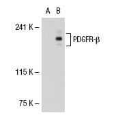 PDGFR-β (P-20): sc-339. Western blot analysis of PDGFR-β expression in non-transfected: sc-117752 (A) and human PDGFR-β transfected: sc-114235 (B) 293T whole cell lysates.