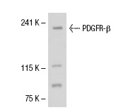 PDGFR-β (P-20): sc-339. Western blot analysis of PDGFR-β expression in CCD-1064Sk whole cell lysate.