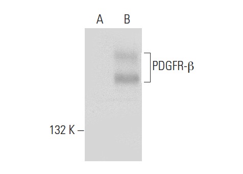 PDGFR-β (P-20)-G: sc-339-G. Western blot analysis of PDGFR-β expression in non-transfected: sc-117752 (A) and human PDGFR-β transfected: sc-159386 (B) 293T whole cell lysates.