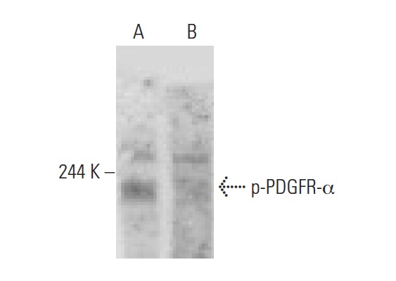 p-PDGFR-α (Tyr 720)-R: sc-12910-R. Western blot analysis of PDGFR-α phosphorylation in untreated (A) and lambda protein phosphatase (sc-200312A) treated (B) NIH/3T3 whole cell lysates.