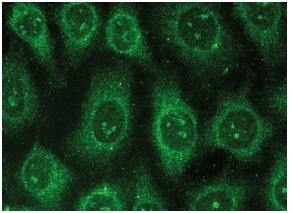 p-PDGFR-β (F-10): sc-365464. Immunofluorescence staining of methanol-fixed HeLa cells showing cytoplasmic localization.