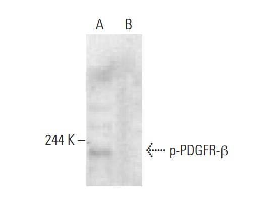 p-PDGFR-β (Tyr 1009)-R: sc-12908-R. Western blot analysis of PDGFR-β phosphorylation in untreated (A) and lambda protein phosphatase (sc-200312A) treated (B) NIH/3T3 whole cell lysates.
