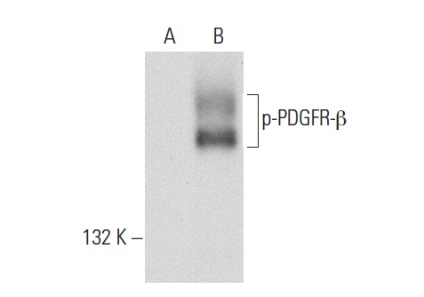 p-PDGFR-β (Tyr 1009)-R: sc-12908-R. Western blot analysis of PDGFR-β phosphorylation in non-transfected: sc-117752 (A) and human PDGFR-β transfected: sc-159386 (B) 293T whole cell lysates.