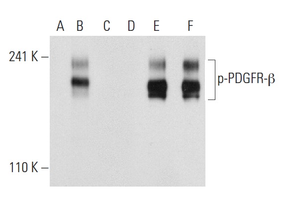 Western blot analysis of PDGFR-β phosphorylation in non-transfected: sc-117752 (A,D), untreated human PDGFR-β transfected: sc-159386 (B,E) and lambda protein phosphatase treated human PDGFR-β transfected: sc-159386 (C,F) 293T whole cell lysates. Antibodies tested include p-PDGFR-β (Tyr 1009)-R: sc-12908-R (A,B,C) and PDGFR-β (11H4): sc-80991 (D,E,F).