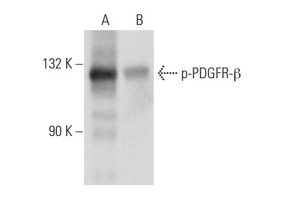 p-PDGFR-β (Tyr 1021)-R: sc-12909-R. Western blot analysis of PDGFR-β phosphorylation in untreated (A) and lambda protein phosphatase (sc-200312A) treated (B) NIH/3T3 whole cell lysates.