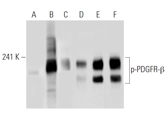Western blot analysis of PDGFR-β phosphorylation in untreated (A,D), PDGF treated (B,E) and PDGF and lambda protein phosphatase treated (C,F) NIH/3T3 whole cell lysates. Antibodies tested include p-PDGFR-β (Tyr 1021)-R: sc-12909-R (A,B,C) and PDGFR-β (11H4): sc-80991 (D,E,F).