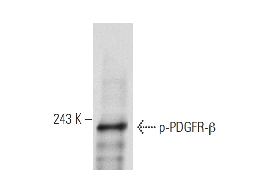 p-PDGFR-β (Tyr 1021)-R: sc-12909-R. Western blot analysis of PDGFR-β phosphorylation in NIH/3T3 whole cell lysate.