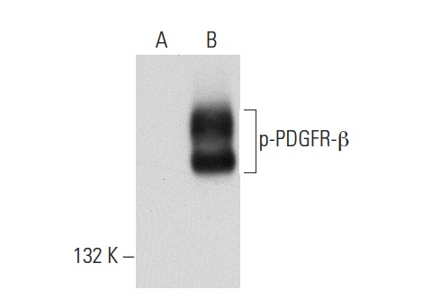 p-PDGFR-β (Tyr 1021): sc-12909. Western blot analysis of PDGFR-β phosphorylation in non-transfected: sc-117752 (A) and human PDGFR-β transfected: sc-159386 (B) 293T whole cell lysates.