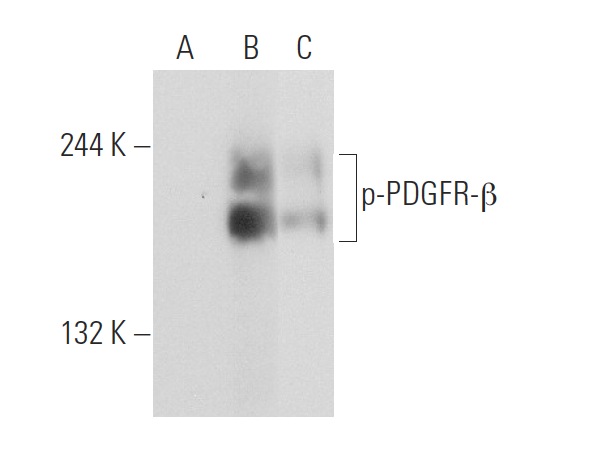 p-PDGFR-β (Tyr 716)-R: sc-16569-R. Western blot analysis of PDGFR-β phosphorylation in non-transfected: sc-117752 (A), untreated human PDGFR-β transfected: sc-159386 (B) and lambda protein phosphatase treated human PDGFR-β transfected: sc-159386 (C) 293T whole cell lysates.