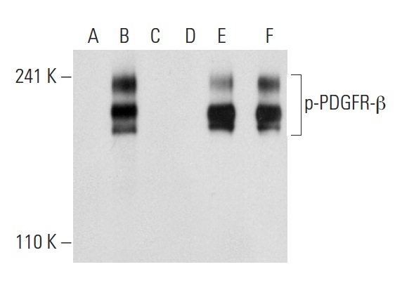 Western blot analysis of PDGFR-β phosphorylation in non-transfected: sc-117752 (A,D), untreated human PDGFR-β transfected: sc-159386 (B,E) and lambda protein phosphatase treated human PDGFR-β transfected: sc-159386 (C,F) 293T whole cell lysates. Antibodies tested include p-PDGFR-β (Tyr 716)-R: sc-16569-R (A,B,C) and PDGFR-β (11H4): sc-80991 (D,E,F).