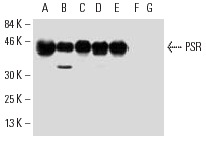 PSR (H-7): sc-28348. Western blot analysis of PSR expression in Caki-1 (A), THP-1 (B), HT-1080 (C), HeLa (D), A549 (E), NIH/3T3 (F) and 3611-RF (G) whole cell lysates.