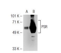 PSR (H-7): sc-28348. Western blot analysis of PSR expression in non-transfected: sc-117752 (A) and human PSR transfected: sc-117004 (B) 293T whole cell lysates.