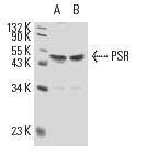 PSR (N-20): sc-11632. Western blot analysis of PSR expression in Caki-1 (A), THP-1 (B), HT-1080 (C), HeLa (D), A549 (E) and NIH/3T3 (F) whole cell lysates.