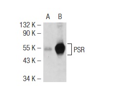 PSR (N-20): sc-11632. Western blot analysis of PSR expression in non-transfected: sc-117752 (A) and mouse PSR transfected: sc-125868 (B) 293T whole cell lysates.