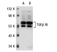 TGFβ RI (R-20): sc-399. Western blot analysis of ACTR-I expression in non-transfected: sc-117752 (A) and human ACTR-I transfected: sc-115007 (B) 293T whole cell lysates.