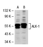 TGFβ RI (R-20): sc-399. Western blot analysis of ALK-1 expression in non-transfected: sc-117752 (A) and mouse ALK-1 transfected: sc-118360 (B) 293T whole cell lysates.