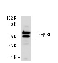 TGFβ RI (R-20): sc-399. Western blot analysis of TGFβ RI expression in Hep G2 whole cell lysate.