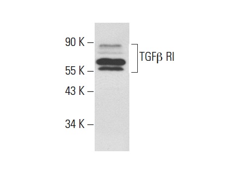 TGFβ RI (R-20): sc-399. Western blot analysis of TGFβ RI expression in PC-3 whole cell lysate.