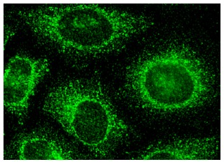 TGFβ RI (R-20): sc-399. Immunofluorescence staining of methanol-fixed HeLa cells showing cytoplasmic localization.