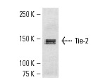 Tie-2 (H-176): sc-9026. Western blot analysis of Tie-2 expression in ECV304 whole cell lysate.