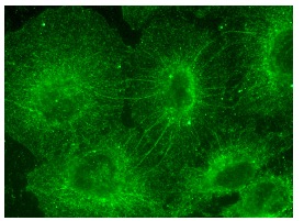 LIF (N-18): sc-1336. Immunofluorescence staining of methanol-fixed HeLa cells showing membrane and cytoplasmic localization.