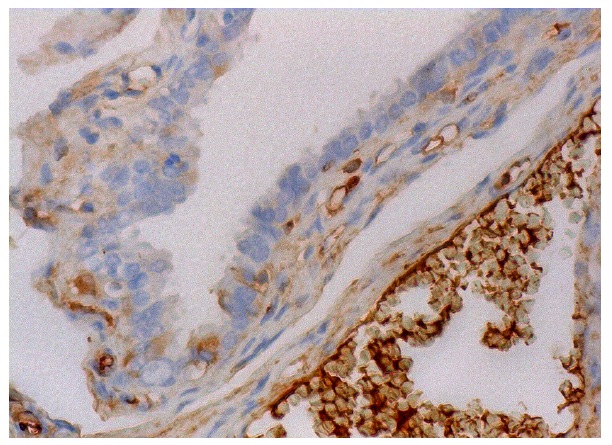 uPAR (E-3): sc-376494. Immunoperoxidase staining of formalin fixed, paraffin-embedded human fallopian tube tissue showing cytoplasmic staining of glandular cells and staining of plasma in blood vessels.