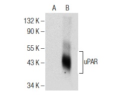 uPAR (E-3): sc-376494. Western blot analysis of uPAR expression in non-transfected: sc-117752 (A) and human uPAR transfected: sc-159642 (B) 293T whole cell lysates.