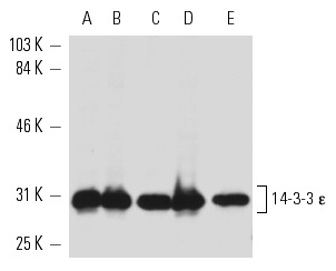 14-3-3 ε (8C3): sc-23957. Western blot analysis of 14-3-3 ε expression in KNRK (A), SW480 (B), T98G (C), EOC 20 (D) and Caco-2 (E) whole cell lysates.