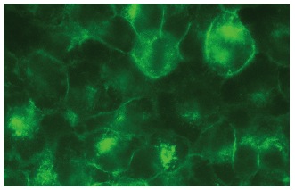 LITAF (D-5): sc-166546. Immunofluorescence staining of methanol-fixed HeLa cells showing membrane localization.