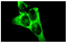 14-3-3 γ (C-16): sc-731. Immunofluorescence staining of methanol-fixed A-431 cells showing cytoplasmic localization.