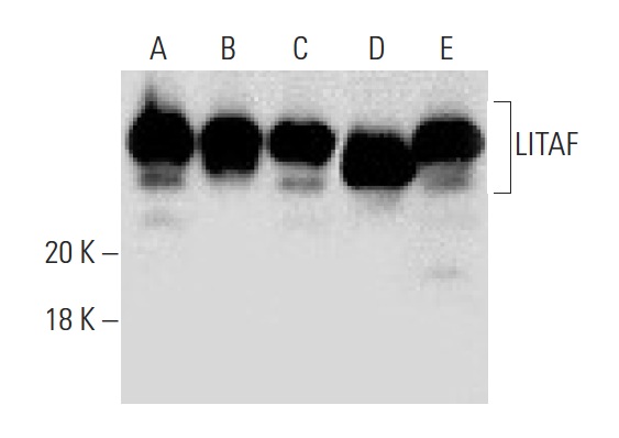 LITAF (D-5): sc-166546. Western blot analysis of LITAF expression in HeLa (A), Hep G2 (B), A-431 (C), LPS treated HL-60 (D) and LPS treated U-937 (E) whole cell lysates.