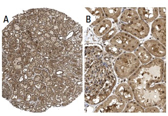 14-3-3 γ (C-16): sc-731. Immunoperoxidase staining of formalin fixed, paraffin-embedded human kidney tissue showing nuclear and cytoplasmic staining of cells in glomeruli and tubules (low and high magnification). Kindly provided by The Swedish Human Protein Atlas (HPA) program.