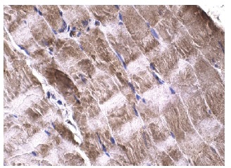 14-3-3 γ (C-16): sc-731. Immunoperoxidase staining of formalin fixed, paraffin-embedded human skeletal muscle tissue showing cytoplasmic staining of myocytes.